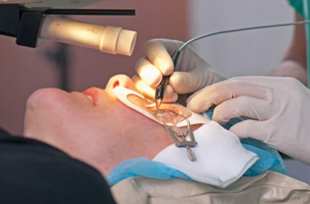 The Complete Guide to Laser Eye Surgery: What You Should Know