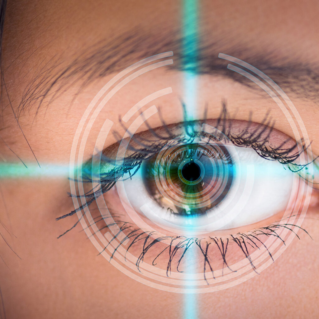 Laser Eye Surgery Sydney: Finding the Best Options for You