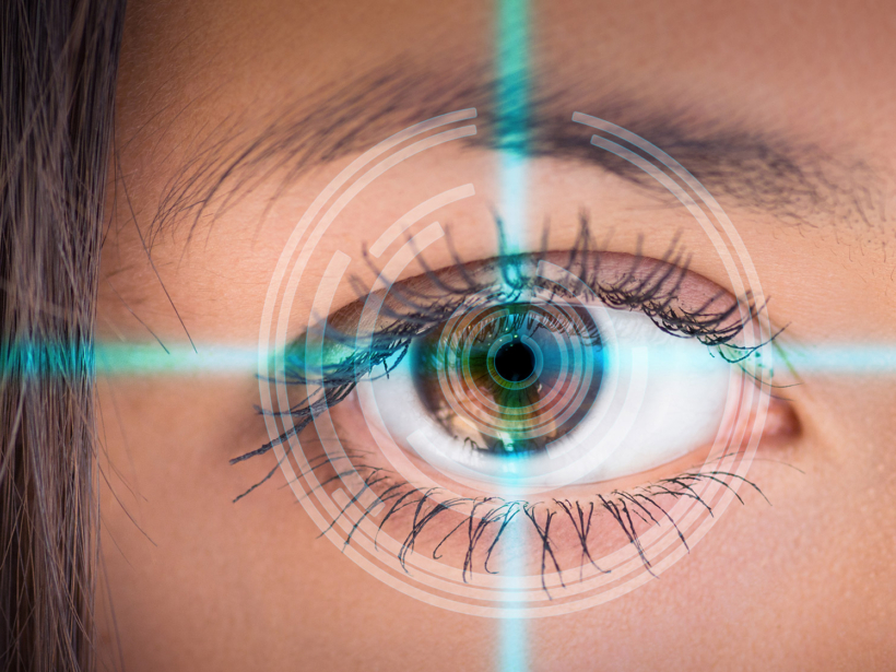 LASIK Eye Surgery